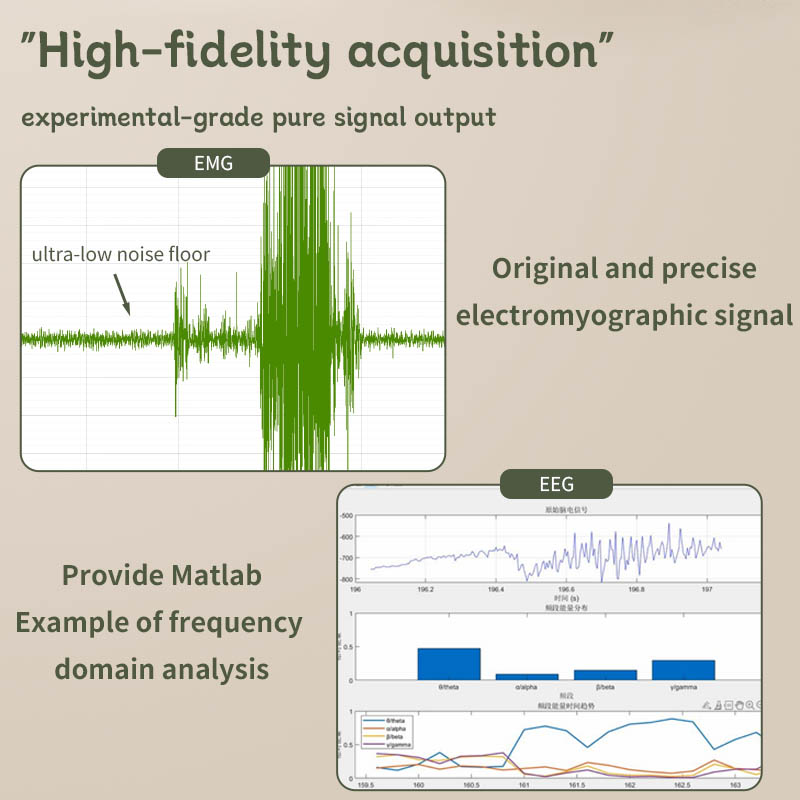 Modulo di Acquisizione EEG EMG - Muscle Sensor Emg recensione e prezzo