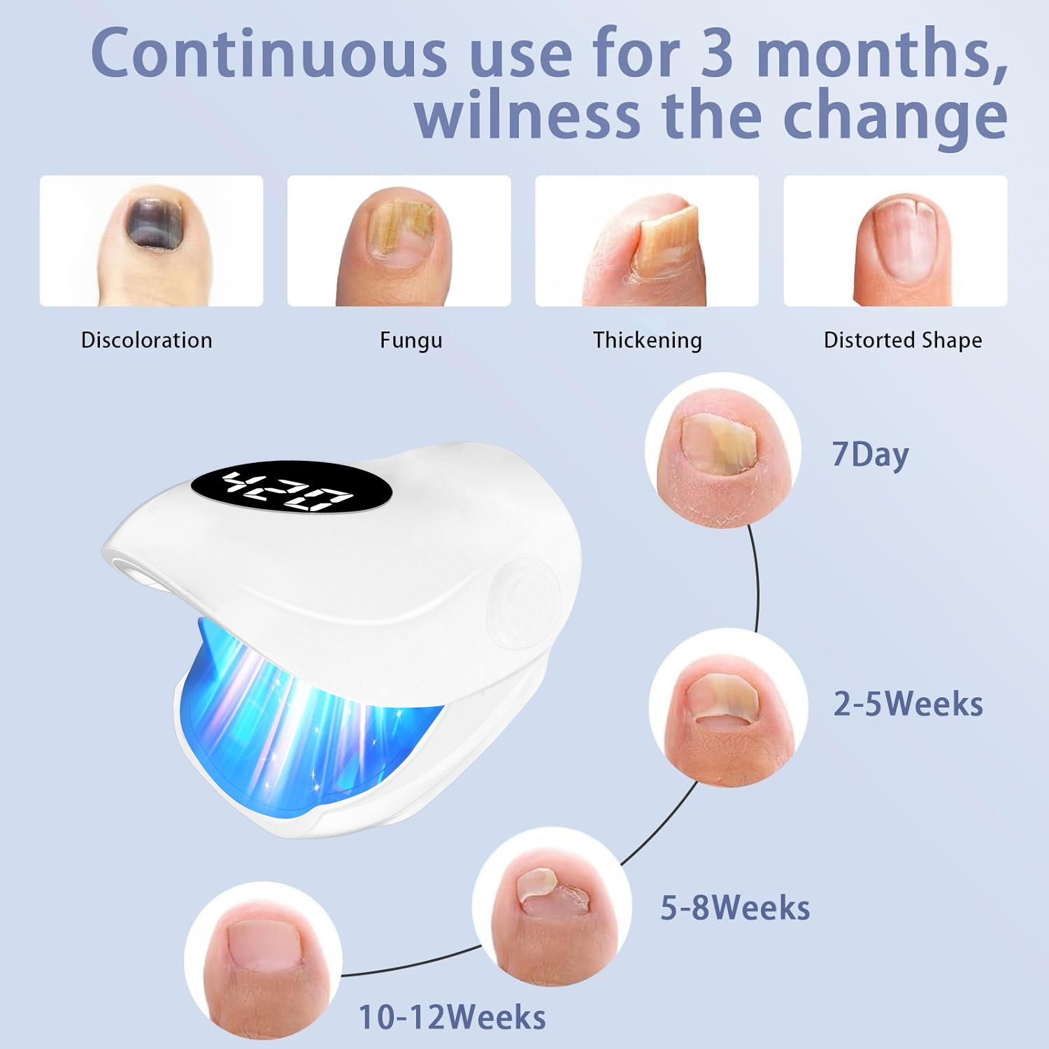 Dispositivo laser per funghi d - Galvanic Skin Sensor recensione e prezzo